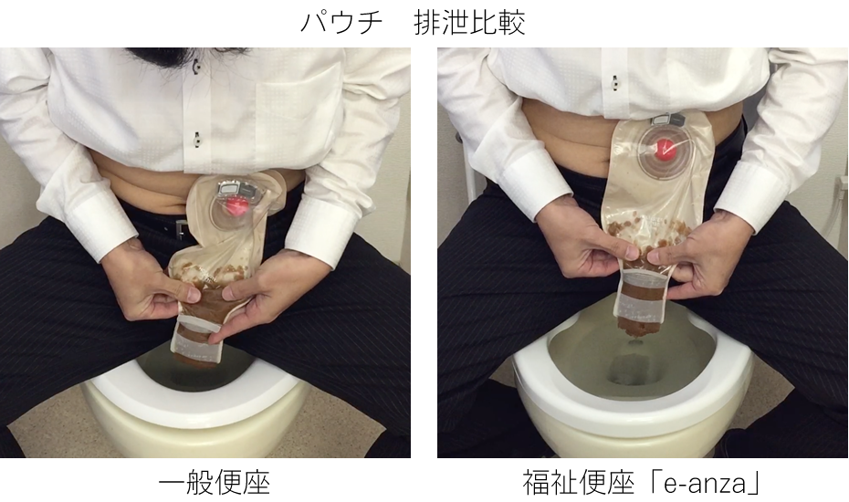 パウチ処理、一般便座とオストメイト対応便座「e-anza」の比較