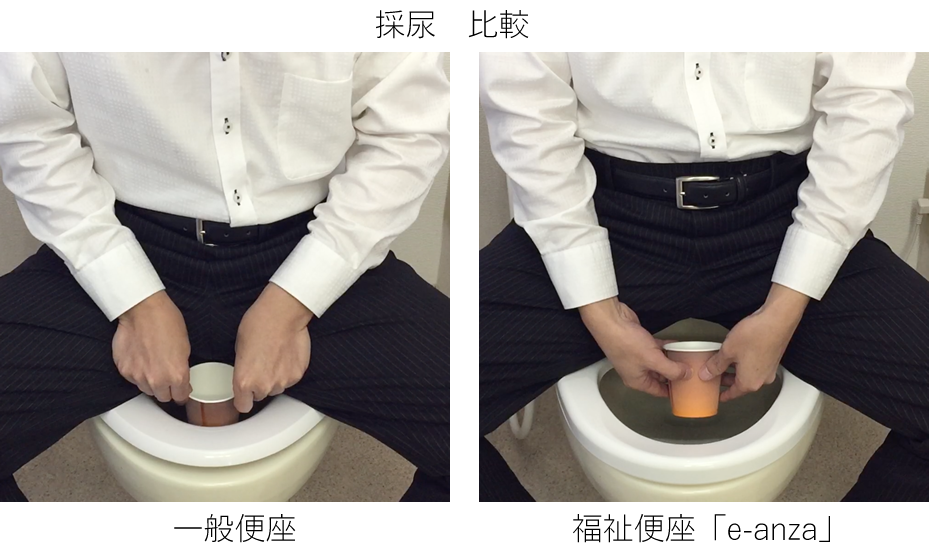 採尿、一般便座とオストメイト対応便座「e-anza」の比較